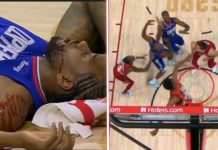 NBA: Kawhi dostał z łokcia, nie obyło się bez szwów