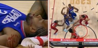 NBA: Kawhi dostał z łokcia, nie obyło się bez szwów