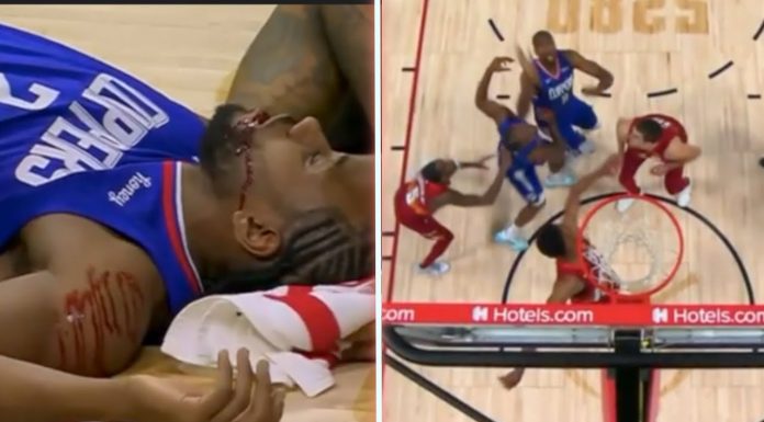 NBA: Kawhi dostał z łokcia, nie obyło się bez szwów