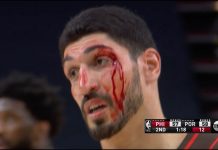 NBA: Kanter dostał z łokcia. Zalał się krwią