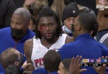 NBA: Zakrwawiony Isaiah Stewart próbował dorwać LeBrona Jamesa!