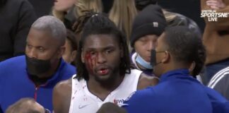 NBA: Zakrwawiony Isaiah Stewart próbował dorwać LeBrona Jamesa!