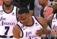 NBA: Zakrwawiony Westbrook po starciu z graczem Spurs