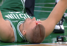 NBA: Chwile grozy w Bostonie! Twarz cała we krwi