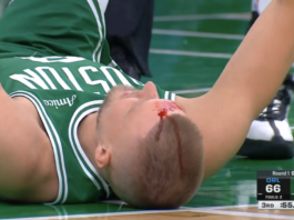 NBA: Chwile grozy w Bostonie! Twarz cała we krwi