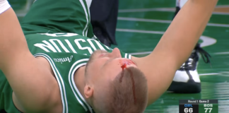 NBA: Chwile grozy w Bostonie! Twarz cała we krwi